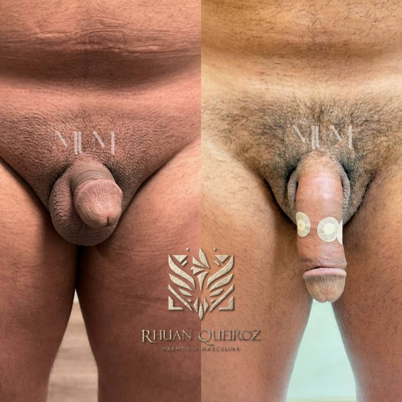 Resultado real 3 do Método Mastro Up Men